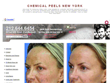 Tablet Screenshot of chemicalpeelsnewyork.org